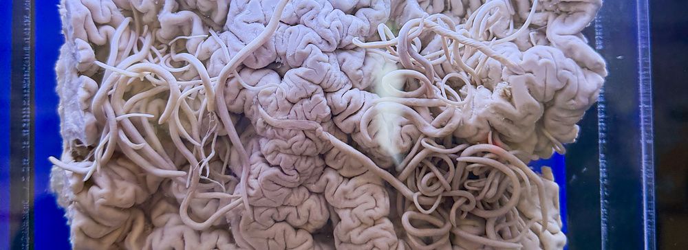 Anisakis simplex in una teca al Museo dei Parassiti di Tokyo.